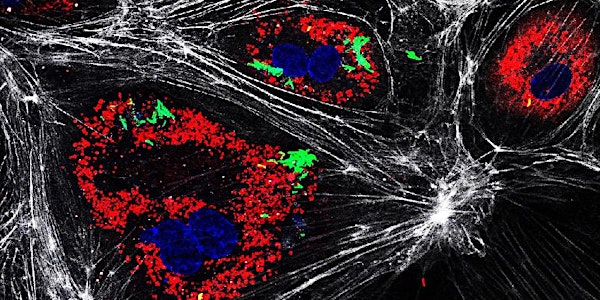 The UK Cellular Microbiology Network:Exploring the host-bacterial interface
