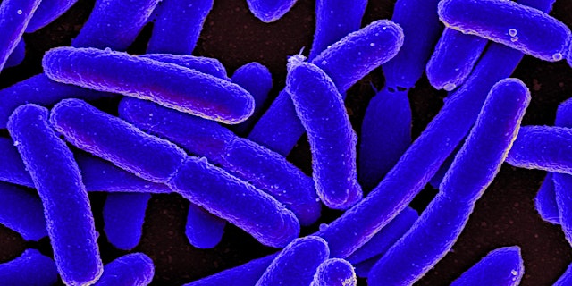 Image principale de Fall 2026 CD 101: Communicable Disease Control - The Basics