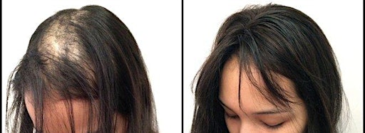 Afbeelding van collectie voor Medical Wigs:Accept Ins. and VA Benefits for Wigs