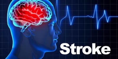 Lezione di aggiornamento rete STROKE Lezione di aggiornamento rete STROKE