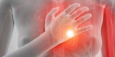 Lezione di aggiornamento rete STEMI Lezione di aggiornamento rete STEMI