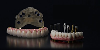 Guided Implant Placement for Full Arch Restoration I Fairfax, VA primary image