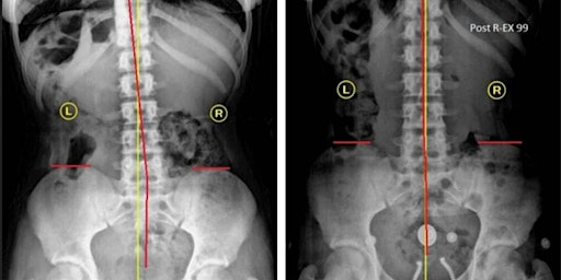 Primaire afbeelding van Spinal Manipulation therapies - Dallas, TX