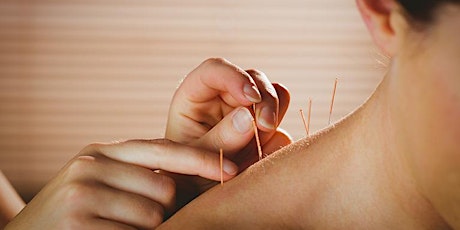 Image principale de Exploring Acupuncture: A Path to Wellness
