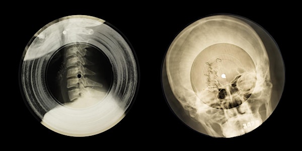 Music on the Bone: The Extraordinary History of the X-Ray record