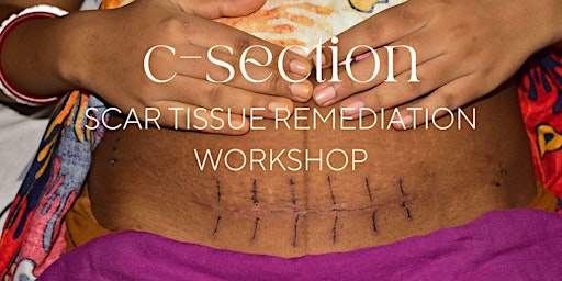 C- Section Scar Tissue Remediation Workshop primary image