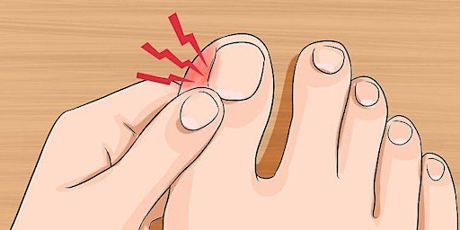 Practical Implementation - The Treatment of Ingrown Toenails primary image
