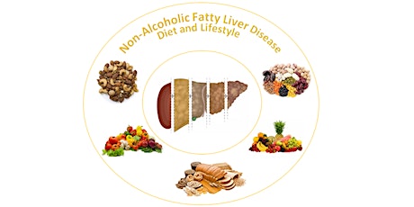 Non-alcoholic Fatty Liver Disease (NAFLD) - Diet and Lifestyle