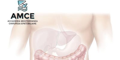3° Caffè dell'Accademia - Tumore al colon con metastasi epatiche 3° Caffè dell'Accademia - Tumore al colon con metastasi epatiche