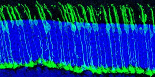 Frontiers in Translational Research of the Visual and Central Nervous Syste...