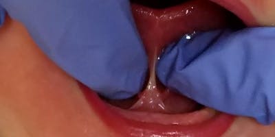 TOTS: Tethered Oral Tissues Specialty Training Houston, TX September 13-14, 2019