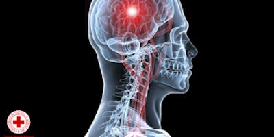 Corso “Sistema Nervoso e Apparato Locomotore: come è fatto, disturbi, traumi cranici e vertebrali, lesioni muscolo scheletriche e traumi osteoarticolari”
