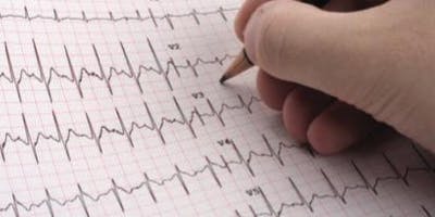 Scst Diploma Ecg Interpretation Course Birmingham February