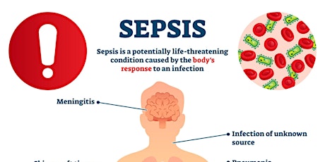 SEPSIS - WHAT'S NEW? primary image