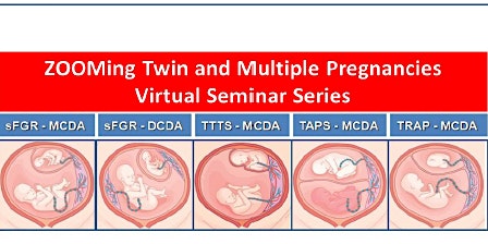 Immagine principale di Previable PPROM in singleton and twin pregnancies: Panel discussion 