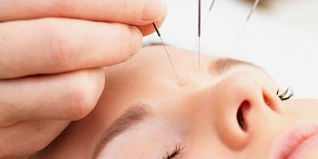 ATELIER jeunes parents - Démystifier l’acupuncture pour les enfants primary image