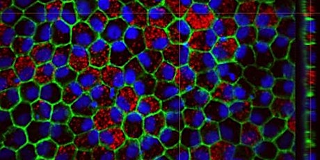 Unlocking Potential: Stem Cells and the Future of Vision Restoration  primärbild