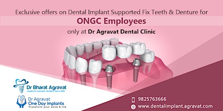Exclusive Offer for ONGC Employees Fix Teeth/Denture By Dental Implants at Dr Bharat Agravat Dental Clinic primary image