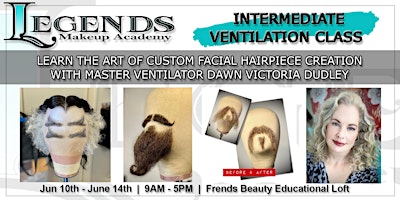 Imagen principal de Intermediate Ventilation