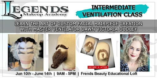 Imagen principal de Intermediate Ventilation