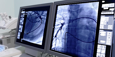 What is Vascular Interventional Radiology and Who Can it Help? primary image