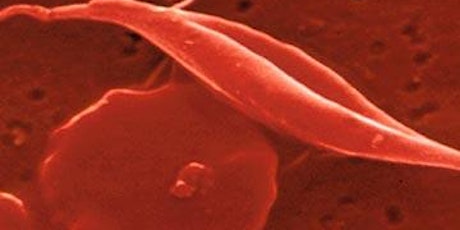 Sickle Cell Disease in the Heartland, A Closer Look primary image