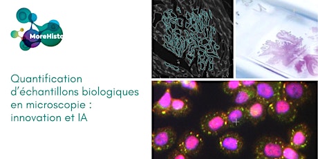 Quantification d’échantillons biologiques en microscopie : innovation et IA