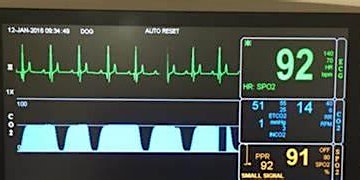 Imagem principal de Capnography for VNs - 2hr FREE CPD for RVNs by Liza Ebeck RVN (JSVC)