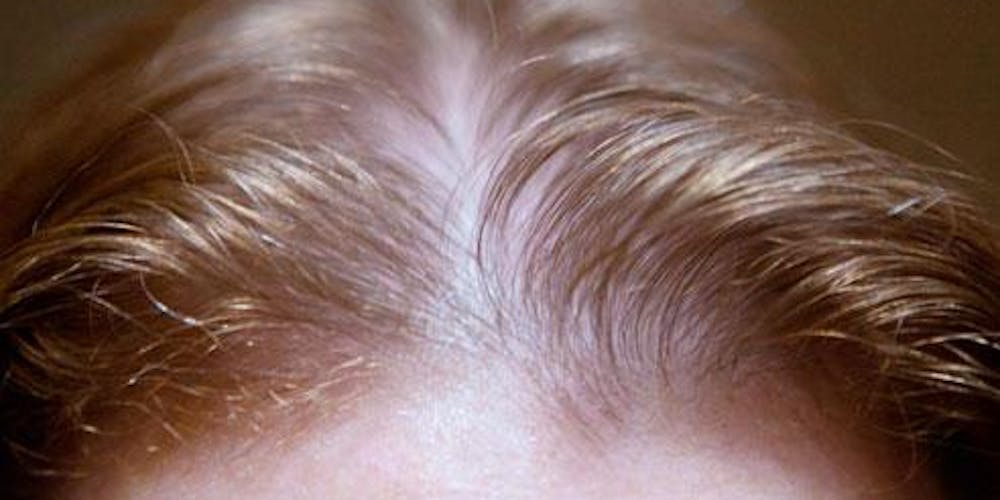 Help For Thinning Hair Hairstyle Men