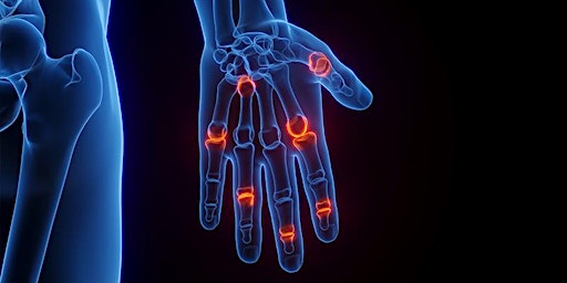 Immagine principale di 2024 Rheumatoid Arthritis Research Summit 