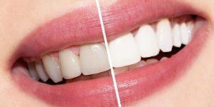 Imagem principal do evento Charlotte NC Teeth Whitening/Tooth Gem Course