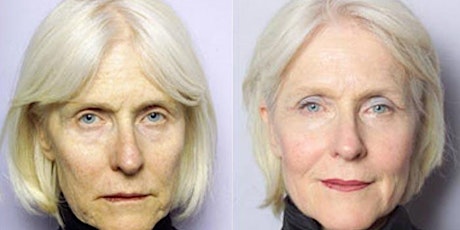 Sculptra Aesthetic Injection Training - Las Vegas, NV primary image