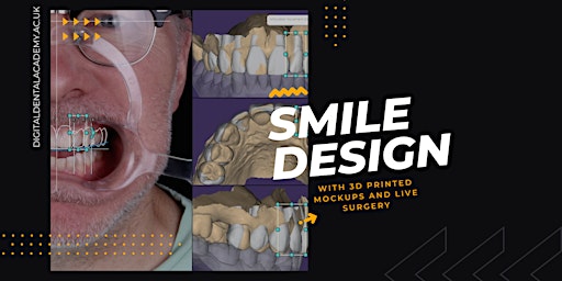 Primaire afbeelding van Guided Smile Concept: Minimally Invasive DIGITAL Same Day Smile Design