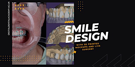 Guided Smile Concept: Minimally Invasive DIGITAL Same Day Smile Design