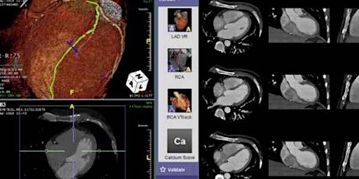 Imagen principal de Cardiac CT for Radiographers Course