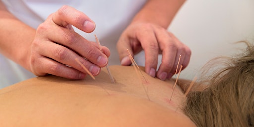 Exclusive Low-cost Acupuncture Clinic primary image