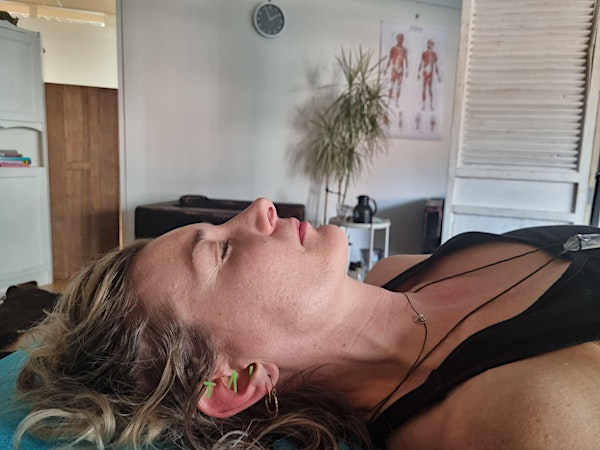 Acupuncture guided meditation