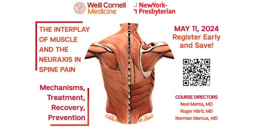 Image principale de The Interplay of Muscle and the Neuraxis in Spine Pain (CME)