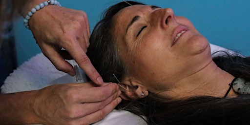 Image principale de Community Acupuncture w/ Hillary Morris