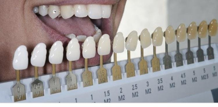 Certified Teeth Whitening Course 19 Years in the Dental Field 