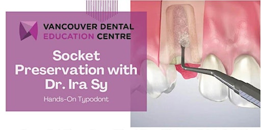 Primaire afbeelding van VDEC Socket Preservation with Dr. Ira Sy