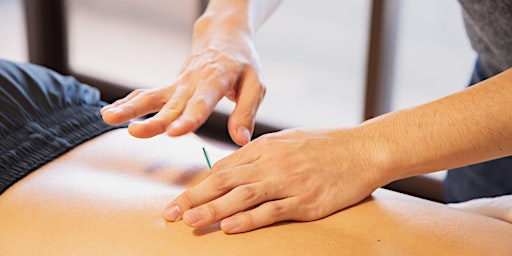 Acupuncture Practical Workshop primary image