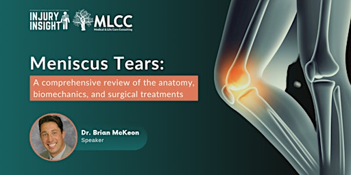 Hauptbild für Meniscus Tears: A comprehensive review of the anatomy, biomechanics