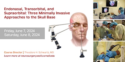 Imagem principal do evento Endonasal, Transorbital, Supraorbital:  3 MIS Approaches to Skull Base(CME)