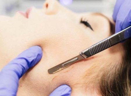 Dermaplane 101