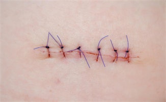 Primaire afbeelding van 2hrs CPD Practical work shop; All Sewn Up - The art of suturing for RVNs