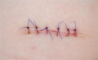 Imagem principal do evento 2hrs CPD Practical work shop; All Sewn Up - The art of suturing for RVNs