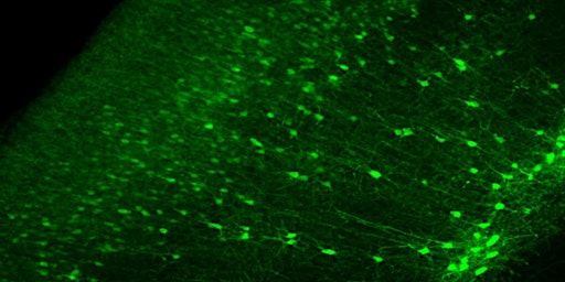 MRC  CNDD & NIHR/MRC mTOR Pathway Diseases Node 2024 Symposium primary image