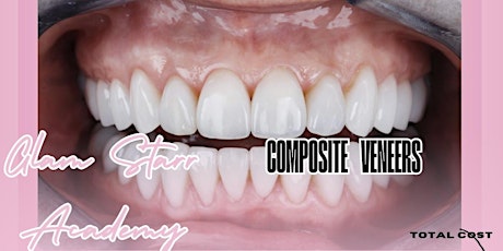 COMPOSITE VENEERS MASTER CLASS! & LIVE DEMONSTRATION