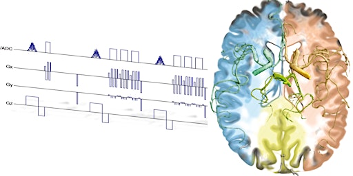 Imagem principal do evento MRI Sequence Composition Beyond Academia [Talk]